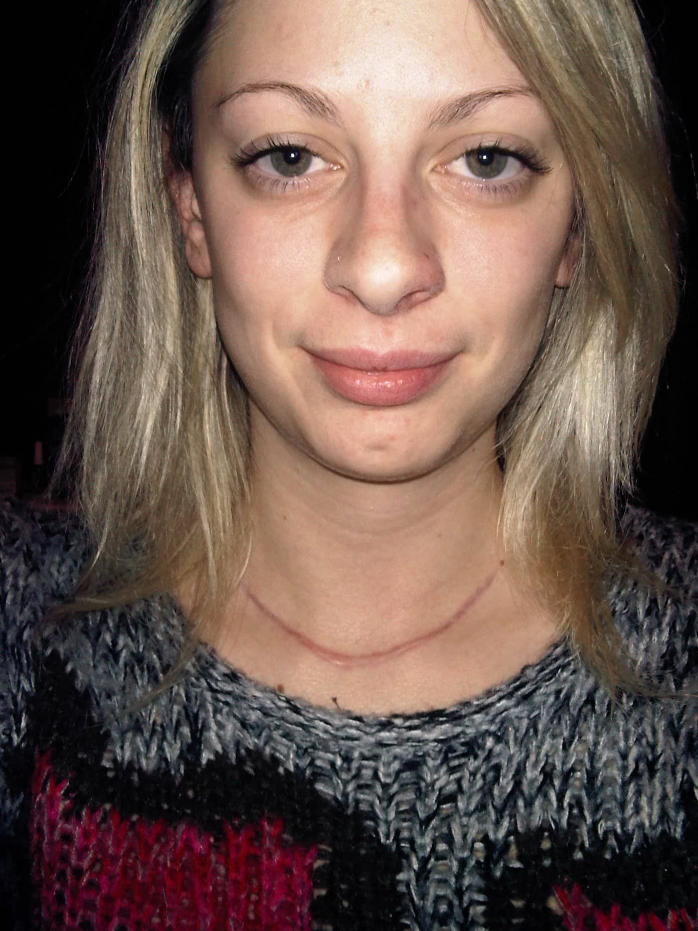 2011-03-12B